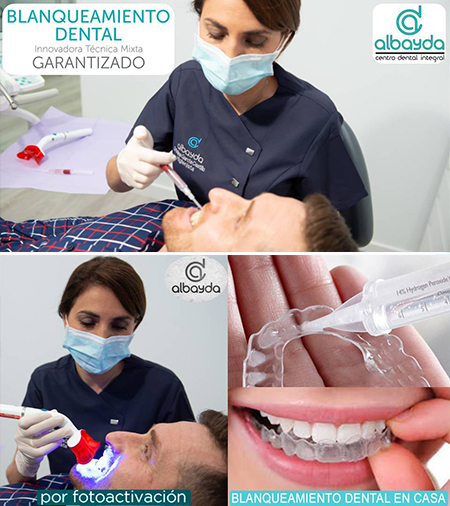 blanqueamiento-dental-garantizado