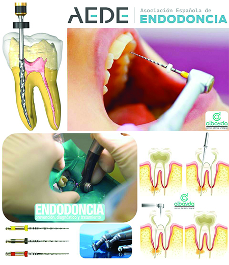 especialista-endodoncia