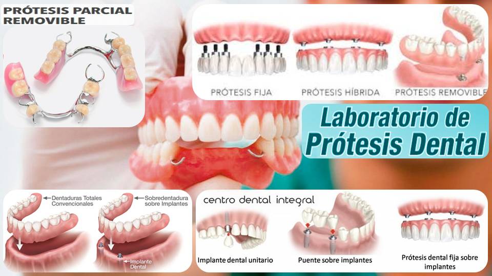 laboratorio-protesis-dental